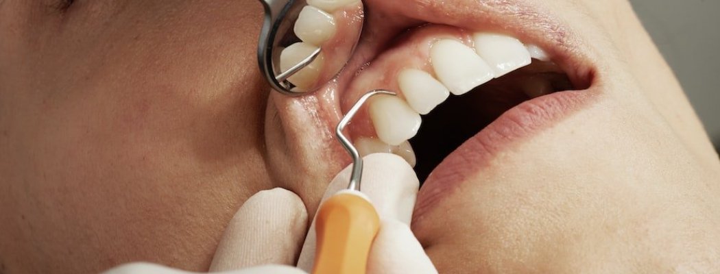 Wat moet je doen als je bang bent voor de tandarts?