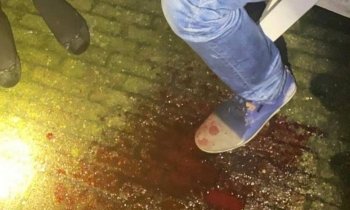 Man verliest hand na vuurwerkongeluk De Kwakel