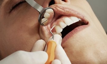 Wat moet je doen als je bang bent voor de tandarts?